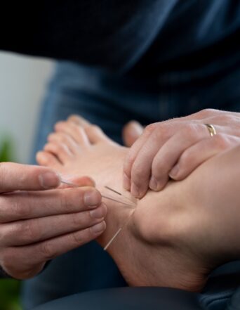 Dry Needling