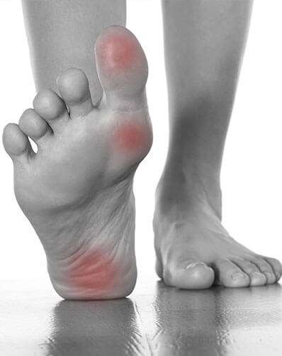 Overview on Physiotherapy Management of Plantar Fasciitis.