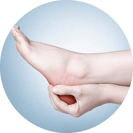 Heel Pain